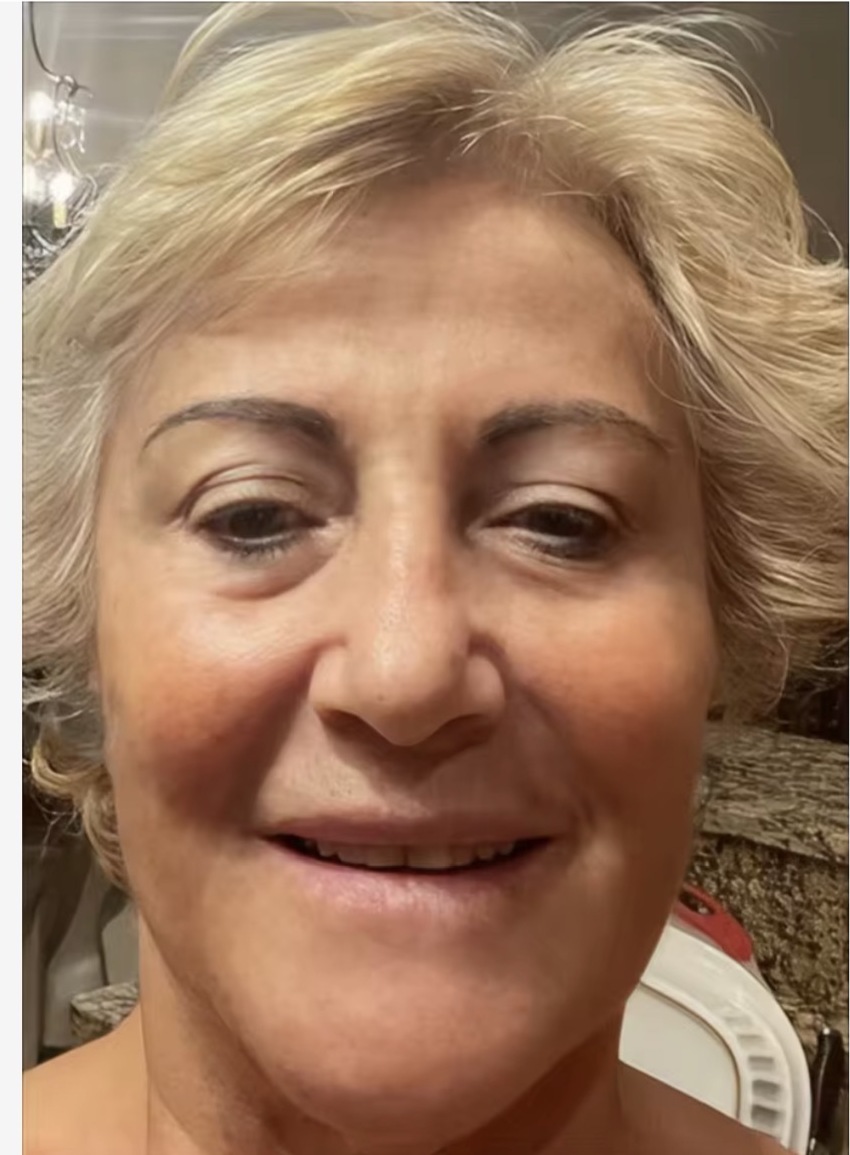Después del uso, testimonio de A***n