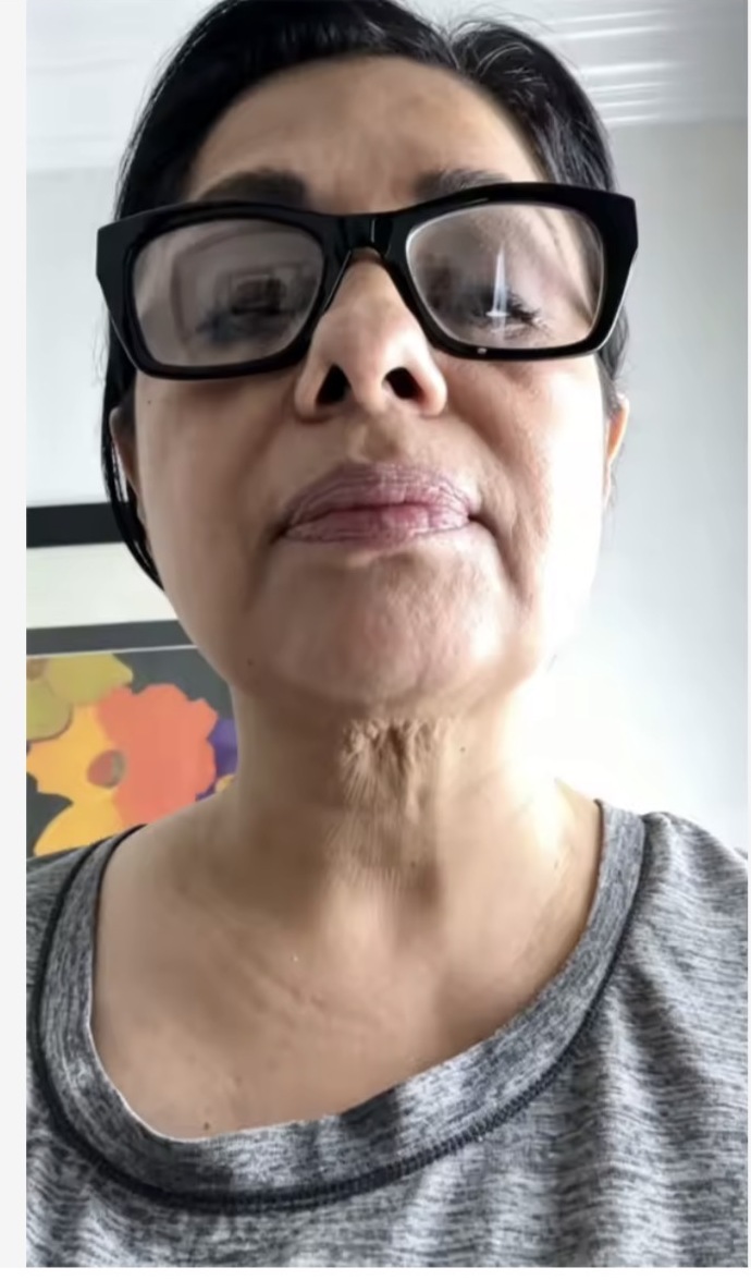 Antes del uso, testimonio de H***l